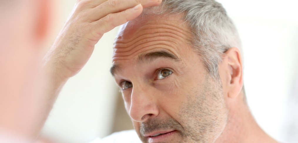 Hair Loss Does Not Have To Be Permanent
