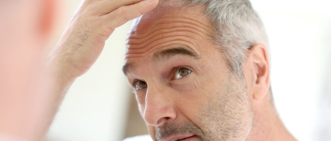 Hair Loss Does Not Have To Be Permanent